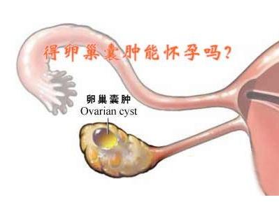 如果囊肿偏大,恶性概率较高,可能会出现排卵障碍,或者造成输卵管不