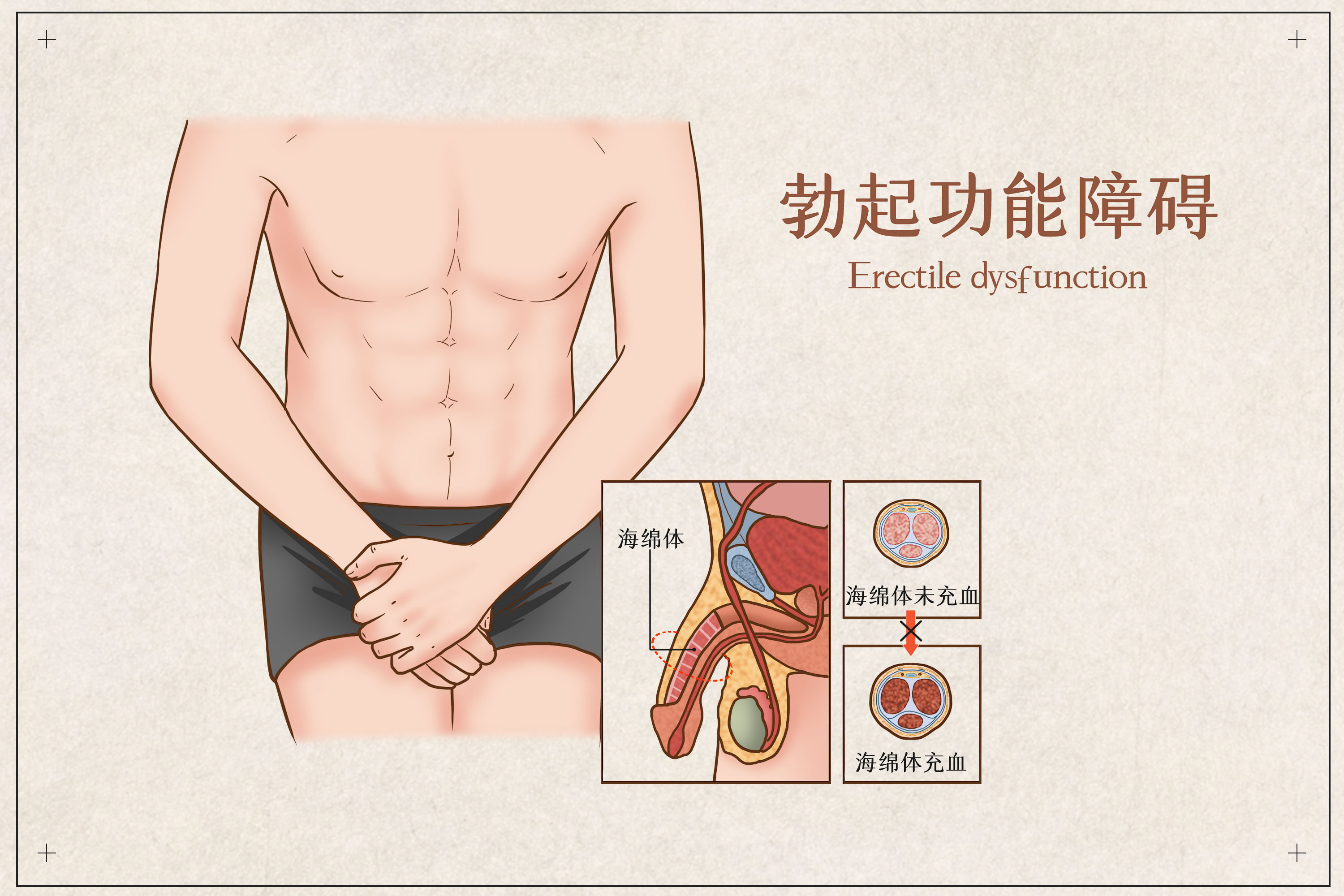 为什么勃起功能障碍患者容易得心血管疾病？