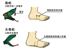 毒蛇咬伤中毒的概述