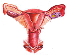 女性生殖器官发育异常的概述