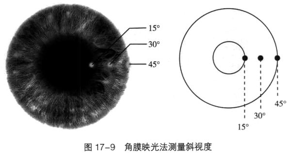 斜视的斜视角检查