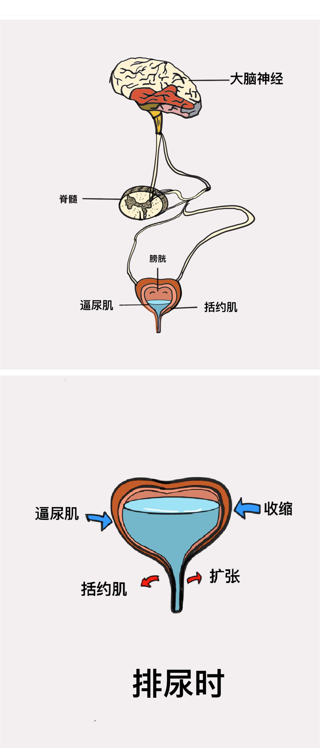 Proteinuria