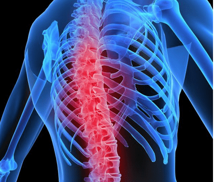 强直性脊柱炎患者在家该如何锻炼？