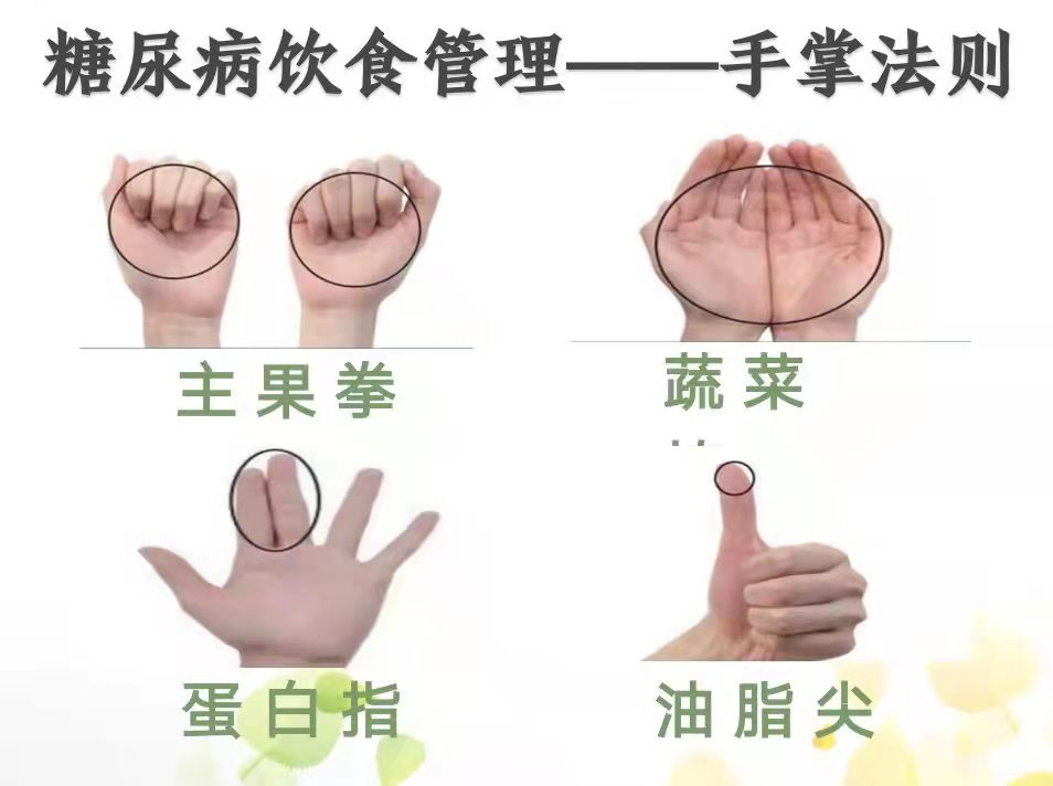 科学管理饮食  遵循“手掌法则”