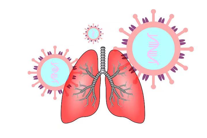 全肺切除的患者应终身预防残肺感染